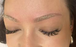 Permanent-Make-Up-Entfernung nachher
